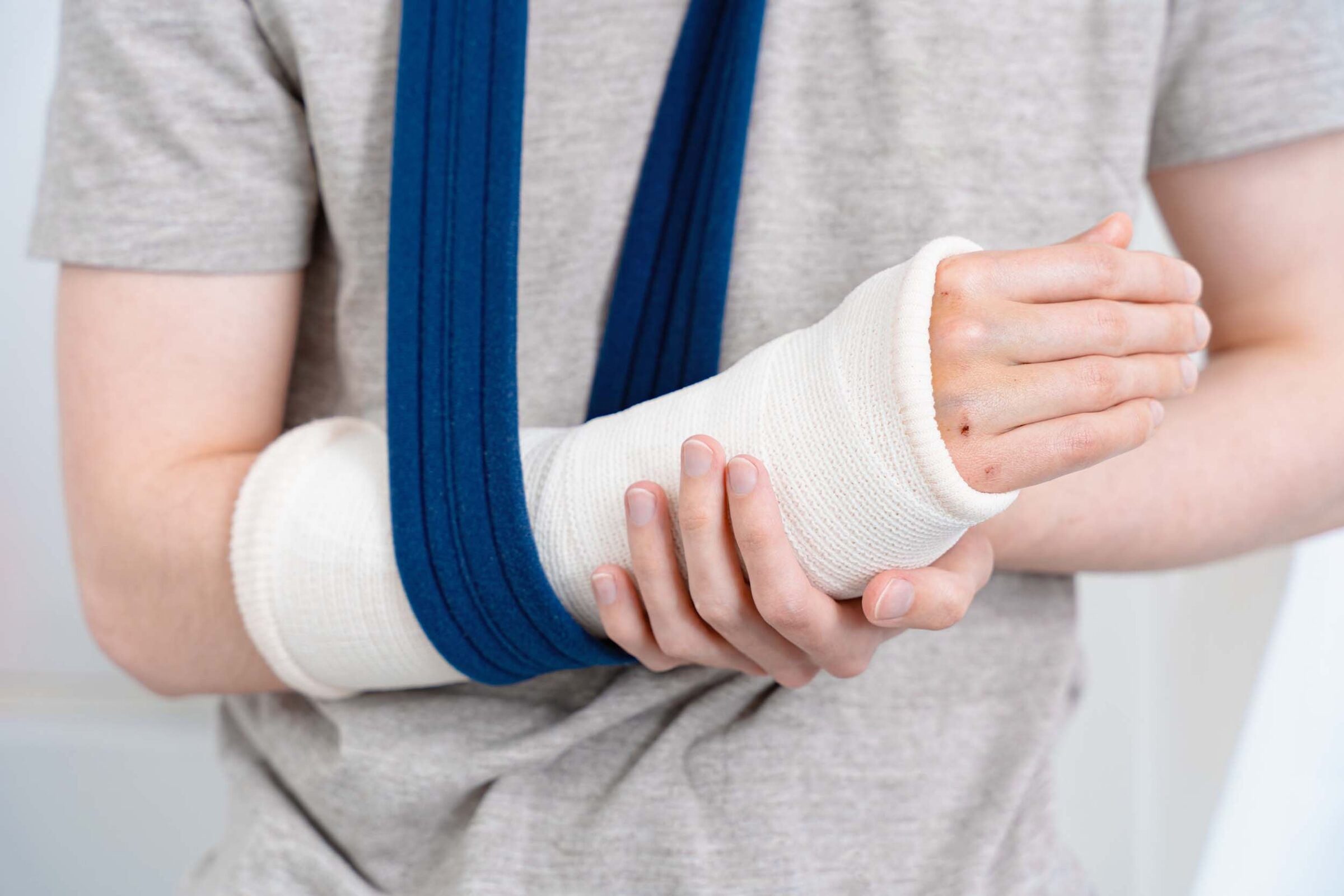 person holding arm in a sling and cast, closeup